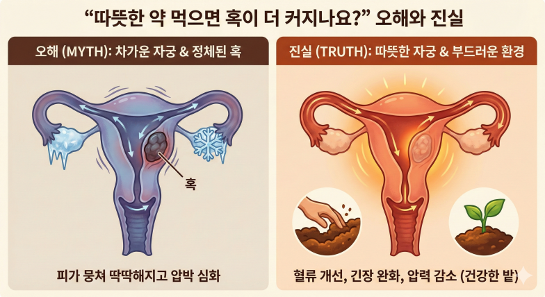 [난임 시리즈 3] 자궁근종 있으면 무조건 수술? 수술 없이 임신 준비하 관련 이미지